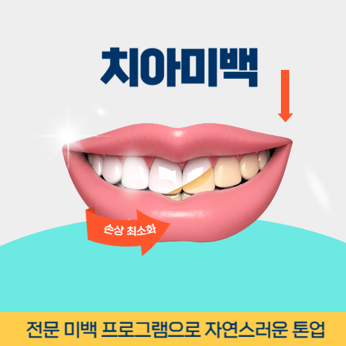 사천치과 사천시 치과 치아미백