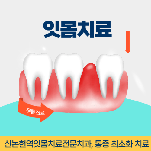 사천치과 사천시 치과 잇몸치료